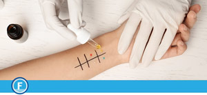 What Is the Most Effective Allergy Test Near Me in Fresno, CA