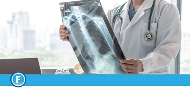 Where to Get An X-Ray Near Me in Fresno CA