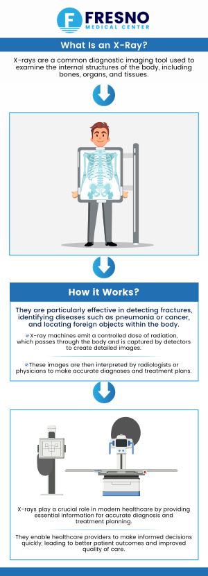X-rays are imaging tests that use safe radiation to generate images of bones and soft tissues and help healthcare providers diagnose various illnesses and plan treatments. At Fresno Medical Center Dr. Gurmej Dhillon, MD and our healthcare professionals offer an on-site x-ray laboratory with same-day interpretation and diagnosis five days a week. Contact us for more information or book an appointment online. We are conveniently located at 6069 N First St. #103, Fresno, CA 93710.
